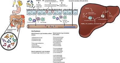 Gut microbiota-modulating agents in alcoholic liver disease: Links between host metabolism and gut microbiota